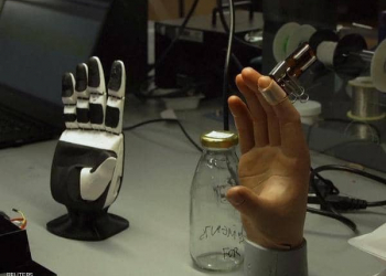 معمل صنع يد اصطناعية اليد الالكترونيه (من الارشيف).