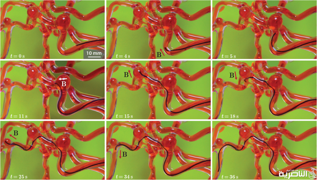ابتكار روبوت يشبه الدودة يزحف عبر المخ لعلاج مرضى السكتة الدماغية